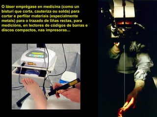 USOS
O láser emprégase en medicina (como un
bisturí que corta, cauteriza ou solda) para
cortar e perfilar materiais (especialmente
metais) para o trazado de liñas rectas, para
medicións, en lectores de códigos de barras e
discos compactos, nas impresoras...
 