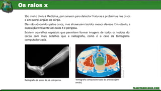 Radiografia de ossos do pé e da perna. Tomografia computadorizada da próstata (em
verde).
Lester
V.
Bergman/Corbis/Latinstock
São muito úteis à Medicina, pois servem para detectar fraturas e problemas nos ossos
e em outros órgãos do corpo.
Existem aparelhos especiais que permitem formar imagens de todos os tecidos do
corpo com mais detalhes que a radiografia, como é o caso da tomografia
computadorizada.
Dept.
Of
Clinical
Radiology,
Salisbury
District
Hospital/Science
Photo
Library/Latinstock
Eles são absorvidos pelos ossos, mas atravessam tecidos menos densos. Entretanto, a
exposição frequente aos raios X é perigosa.
Os raios x
 
