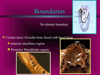 Boundaries 
No distinct boundary 
Certain areas Alveolar bone fused with basal bone 
Anterior maxillary region 
Posterior Mandibular region. 
 