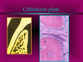 Cribriform plate 
 