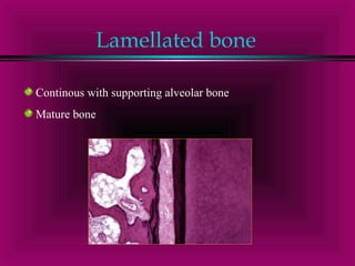 Lamellated bone 
Continous with supporting alveolar bone 
Mature bone 
 