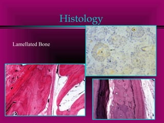 Histology 
Lamellated Bone 
 