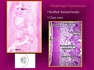 Morphologic Characteristics 
Ruffled/ Striated border 
Clear zone 
 