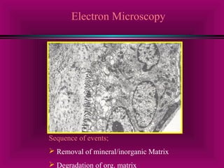 Electron Microscopy 
Sequence of events; 
 Removal of mineral/inorganic Matrix 
 Degradation of org. matrix 
 