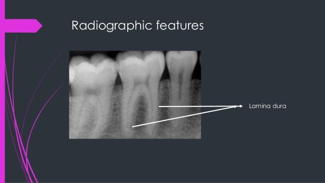Alveolar bone