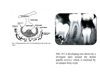 Alveolar bone