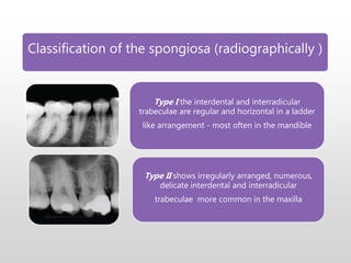 Classification of the spongiosa (radiographically )
Type I the interdental and interradicular
trabeculae are regular and horizontal in a ladder
like arrangement - most often in the mandible
Type II shows irregularly arranged, numerous,
delicate interdental and interradicular
trabeculae more common in the maxilla
 