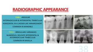 RADIOGRAPHIC APPEARANCE
TYPE I –REGULAR
INTERRADICULAR & INTERDENTAL TRABECULAE
HORIZONTAL IN A LADDER LIKE ARRANGEMENT.
COMMON IN MANDIBLE
TYPE II- IRREGULARLY ARRANGED
NUMEROUS, DELICATE INTERDENTAL &
INTERRADICULAR TRABECULAE
COMMON IN MAXILLA
 