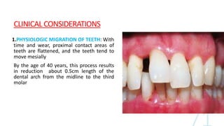 CLINICAL CONSIDERATIONS
1.PHYSIOLOGIC MIGRATION OF TEETH: With
time and wear, proximal contact areas of
teeth are flattened, and the teeth tend to
move mesially
By the age of 40 years, this process results
in reduction about 0.5cm length of the
dental arch from the midline to the third
molar
 