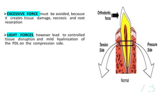 EXCESSIVE FORCE must be avoided, because
it creates tissue damage, necrosis and root
resorption
LIGHT FORCES, however lead to controlled
tissue disruption and mild hyalinization of
the PDL on the compression side.
 