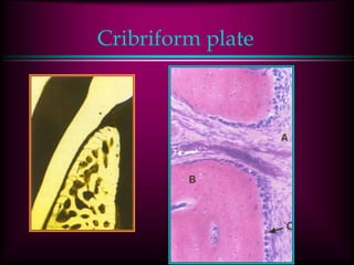 Cribriform plate
 