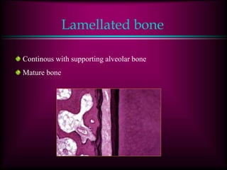 Lamellated bone
Continous with supporting alveolar bone
Mature bone
 