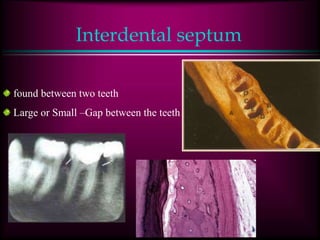 Interdental septum
found between two teeth
Large or Small –Gap between the teeth
 