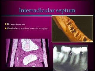 Interradicular septum
Between two roots
Alveolar bone not fused –contain spongiosa
 