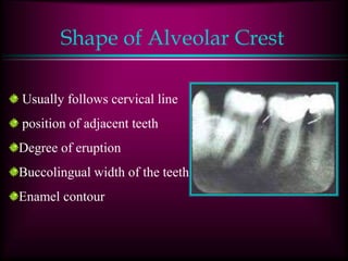 Shape of Alveolar Crest
Usually follows cervical line
position of adjacent teeth
Degree of eruption
Buccolingual width of the teeth
Enamel contour
 