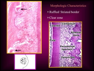 Morphologic Characteristics
Ruffled/ Striated border
Clear zone
 