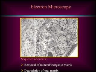 Electron Microscopy
Sequence of events;
 Removal of mineral/inorganic Matrix
 Degradation of org. matrix
 