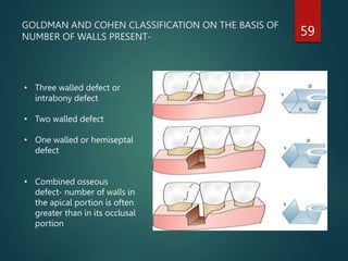 Alveolar bone.pptx