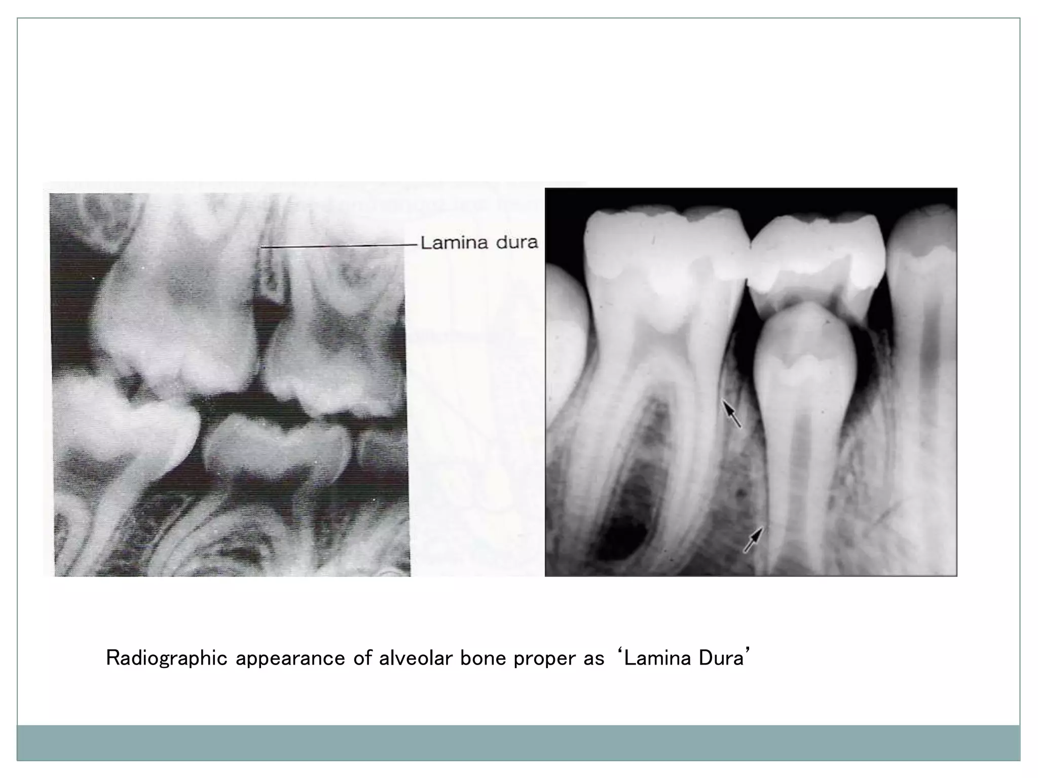 Alveolar bone.ppt