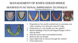 Recorving Ridges ALVEOLAR BONE and residual ridge resorption.pptx