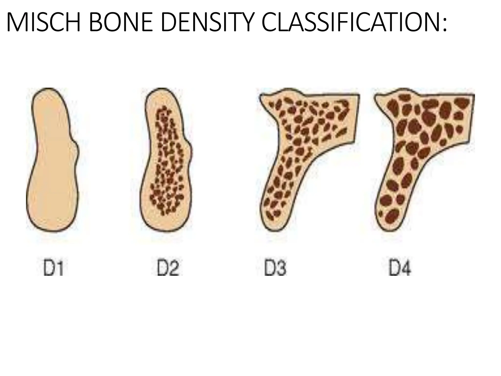 ALVEOLAR BONE IN HEALTH AND DISEASE [Autosaved].ppt