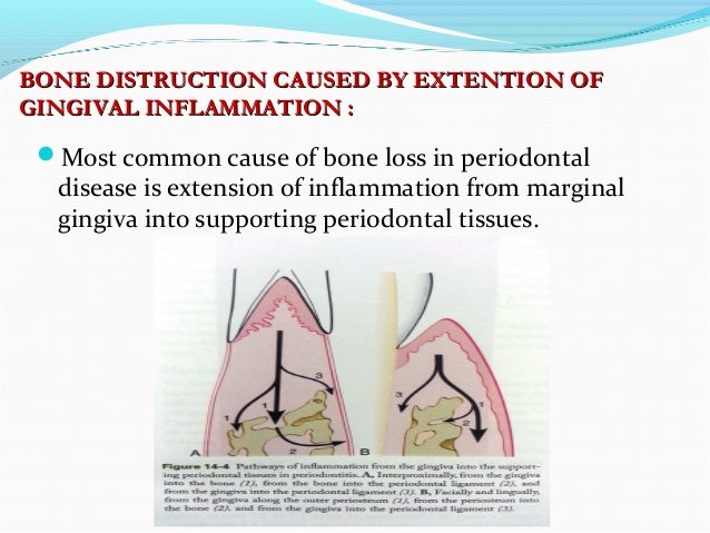 alveolar vs anatomic vs physiologic dead space