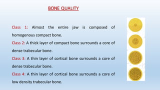 Alveolar bone in prosthodontics | PPTX