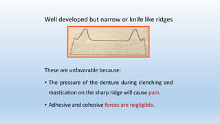 Alveolar bone in prosthodontics | PPTX