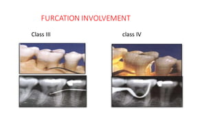 Alveolarbone | PDF