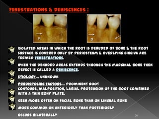 FENESTRATIONS & DEHISCENCES :




   Isolated areas in which the root is denuded of bone & the root
   surface is covered only by periosteum & overlying gingiva are
   termed fenestrations.
   When the denuded areas extends through the marginal bone then
   defect is called a dehiscence.
   Etiology… unknown
   Predisposing factors… prominent root
   contours, malposition, labial protrusion of the root combined
   with a thin bony plate.
   Seen more often on facial bone than on lingual bone
   More common on anteriorly than posteriorly
   Occurs bilaterally                                     26
 