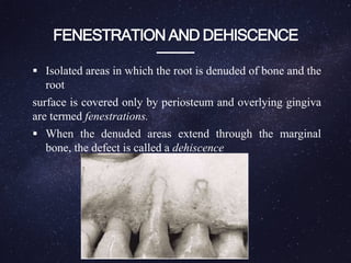 Alveolar process bds class | PPTX