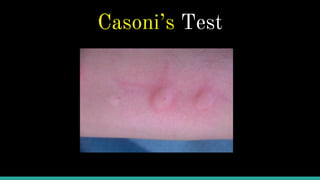 Echinococcosis | PPTX