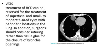 • VATS
treatment of HCD can be
reserved for the treatment
of superficial and small- to
moderate-sized cysts with
peripheric locations in the
lung. In addition, surgeons
should consider suturing
rather than tissue glue for
the closure of bronchial
openings
 