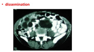 • dissemination
 