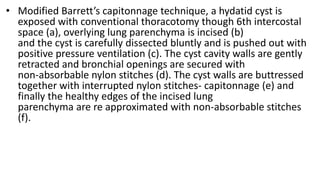 • Modified Barrett’s capitonnage technique, a hydatid cyst is
exposed with conventional thoracotomy though 6th intercostal
space (a), overlying lung parenchyma is incised (b)
and the cyst is carefully dissected bluntly and is pushed out with
positive pressure ventilation (c). The cyst cavity walls are gently
retracted and bronchial openings are secured with
non-absorbable nylon stitches (d). The cyst walls are buttressed
together with interrupted nylon stitches- capitonnage (e) and
finally the healthy edges of the incised lung
parenchyma are re approximated with non-absorbable stitches
(f).
 