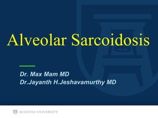 Alveolar Sarcoidosis
Dr. Max Mam MD
Dr.Jayanth H.Jeshavamurthy MD
 