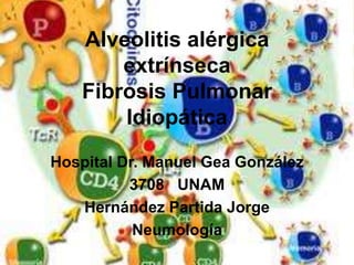 Alveolitis alérgica
extrínseca
Fibrosis Pulmonar
Idiopática
Hospital Dr. Manuel Gea González
3708 UNAM
Hernández Partida Jorge
Neumología
 