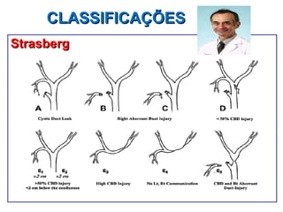 CLASSIFICAÇÕES  Strasberg 