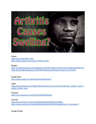 Videos
https://youtu.be/6YOfa1-o2rw
https://www.youtube.com/watch?v=6YOfa1-o2rw
Blogger
https://naturesawesomecures.blogspot.com/2018/01/does-arthritis-cause-swelling-arthritis.html
https://jessiemfleck.blogspot.com/2018/01/arthritis-pain-impact-is-there-cure-for.html
Google Sites
https://sites.google.com/view/naturalremedies/home
reddit
https://www.reddit.com/user/NaturalRemediesForYu/comments/7ryne6/does_arthritis_cause_s
welling_arthritis_pain/
Pinterest
https://www.pinterest.com/pin/670754938224801690/
Channel
https://www.youtube.com/channel/UCNix5vA7wjaOPNSGTdSpKNw
https://www.youtube.com/channel/UCNix5vA7wjaOPNSGTdSpKNw?sub_confirmation=1
Google Sheets
 