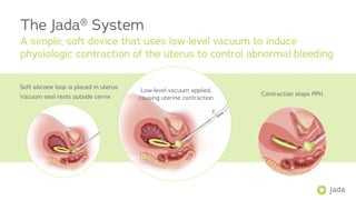 Jada System Guide.pdf Alydia Health | PDF