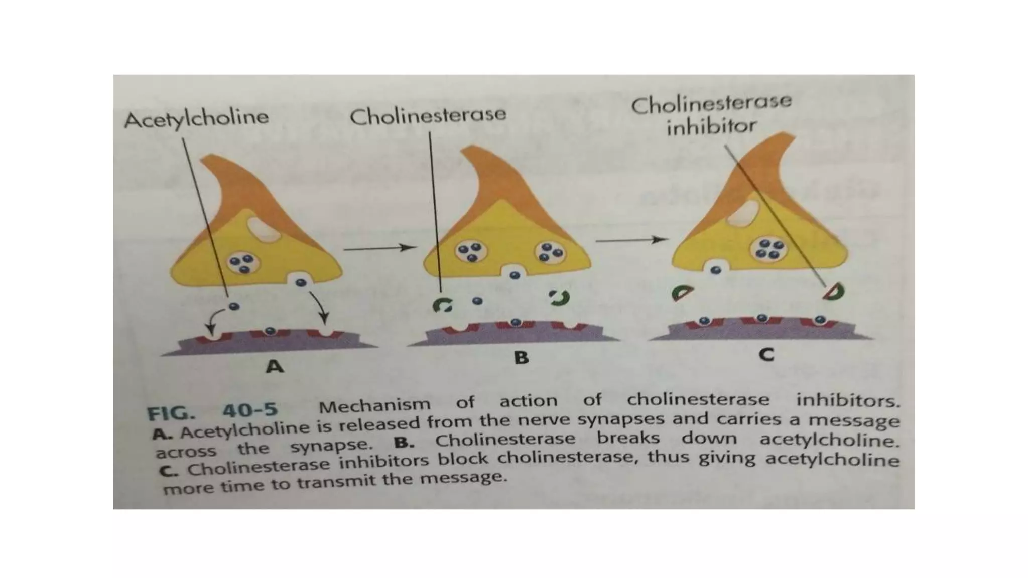 Alzheimer's Disease [A Complete Picture] | PPTX