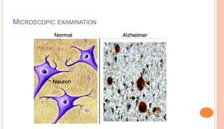 MICROSCOPIC EXAMINATION
 