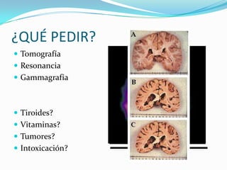 ¿QUÉ PEDIR?TomografíaResonanciaGammagrafíaTiroides?Vitaminas?Tumores?Intoxicación?