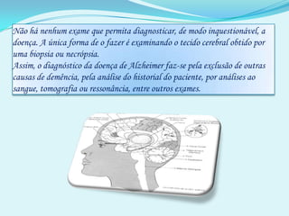 Não há nenhum exame que permita diagnosticar, de modo inquestionável, a doença. A única forma de o fazer é examinando o tecido cerebral obtido por uma biopsia ou necrópsia. Assim, o diagnóstico da doença de Alzheimer faz-se pela exclusão de outras causas de demência, pela análise do historial do paciente, por análises ao sangue, tomografia ou ressonância, entre outros exames. 