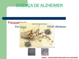 DOENÇA DE ALZHEIMER



Fisiopatologia
     Existência de Emaranhados Neurofibrilares




                          ABRAZ – ASSOCIAÇÃO BRASILEIRA DE ALZHEIMER
 