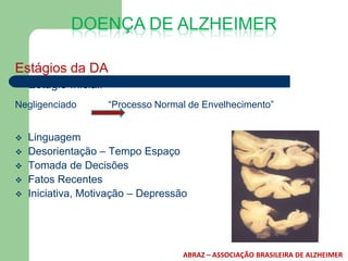 DOENÇA DE ALZHEIMER

Estágios da DA
   Estágio Inicial:
Negligenciado          “Processo Normal de Envelhecimento”


   Linguagem
   Desorientação – Tempo Espaço
   Tomada de Decisões
   Fatos Recentes
   Iniciativa, Motivação – Depressão




                                      ABRAZ – ASSOCIAÇÃO BRASILEIRA DE ALZHEIMER
 
