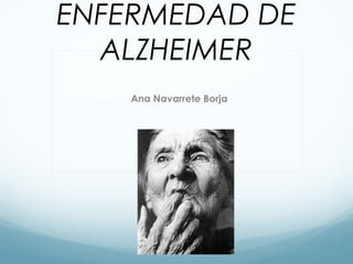 ENFERMEDAD DE
ALZHEIMER
Ana Navarrete Borja

 