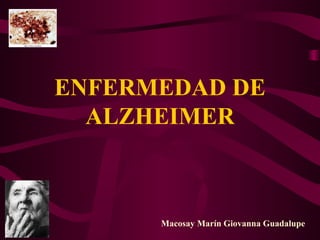ENFERMEDAD DE
ALZHEIMER

Macosay Marín Giovanna Guadalupe

 