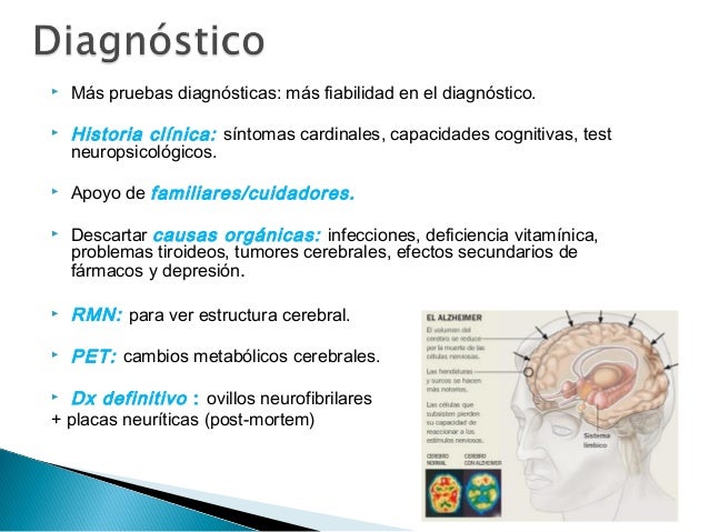 Tratamiento Farmacológico de las Demencias tipo Alzheimer Tratamiento Farmacológico de las Demencias tipo Alzheimer