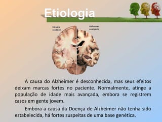 A causa do Alzheimer é desconhecida, mas seus efeitos
deixam marcas fortes no paciente. Normalmente, atinge a
população de idade mais avançada, embora se registrem
casos em gente jovem.
Embora a causa da Doença de Alzheimer não tenha sido
estabelecida, há fortes suspeitas de uma base genética.
 